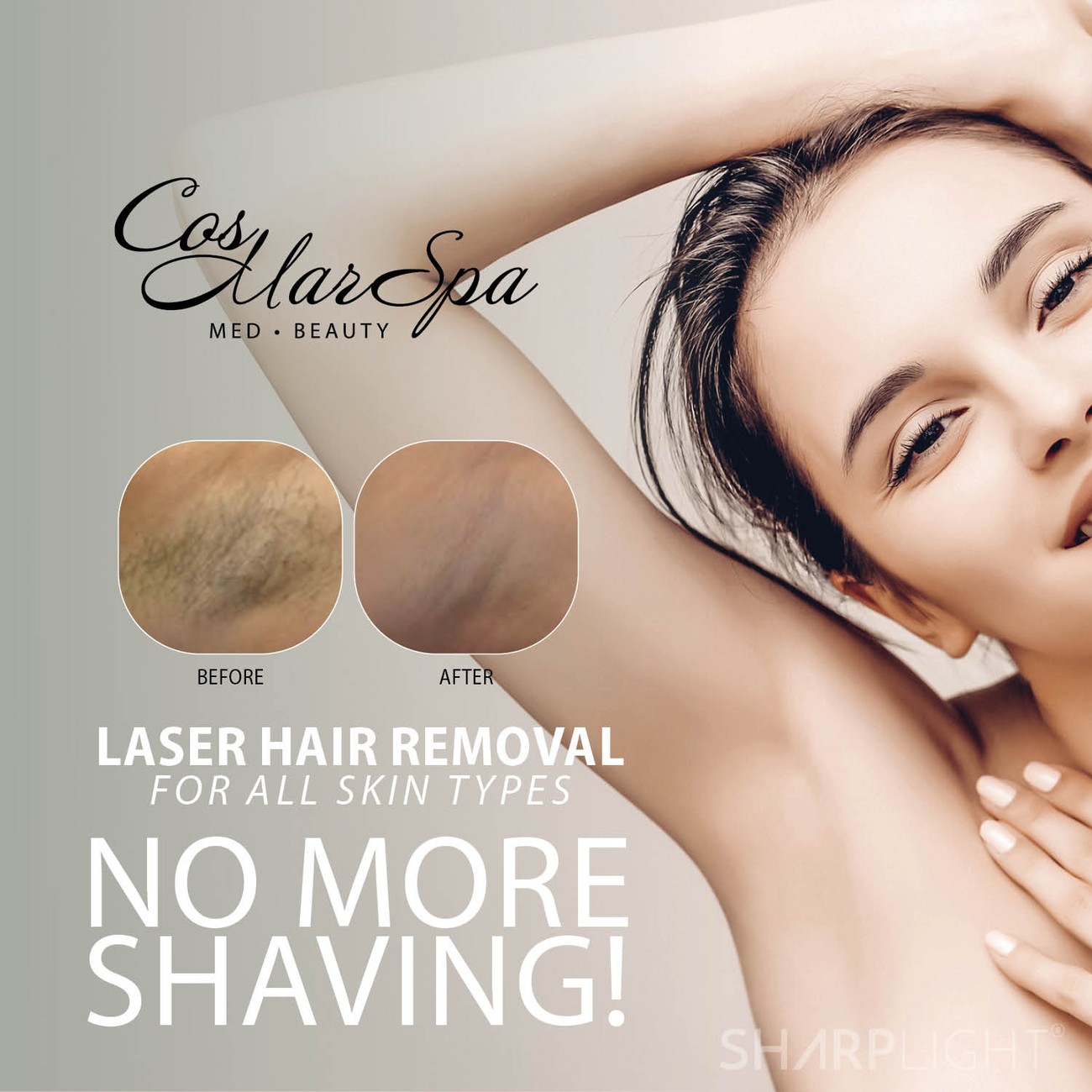 Laser hair removal at CosMarSpa