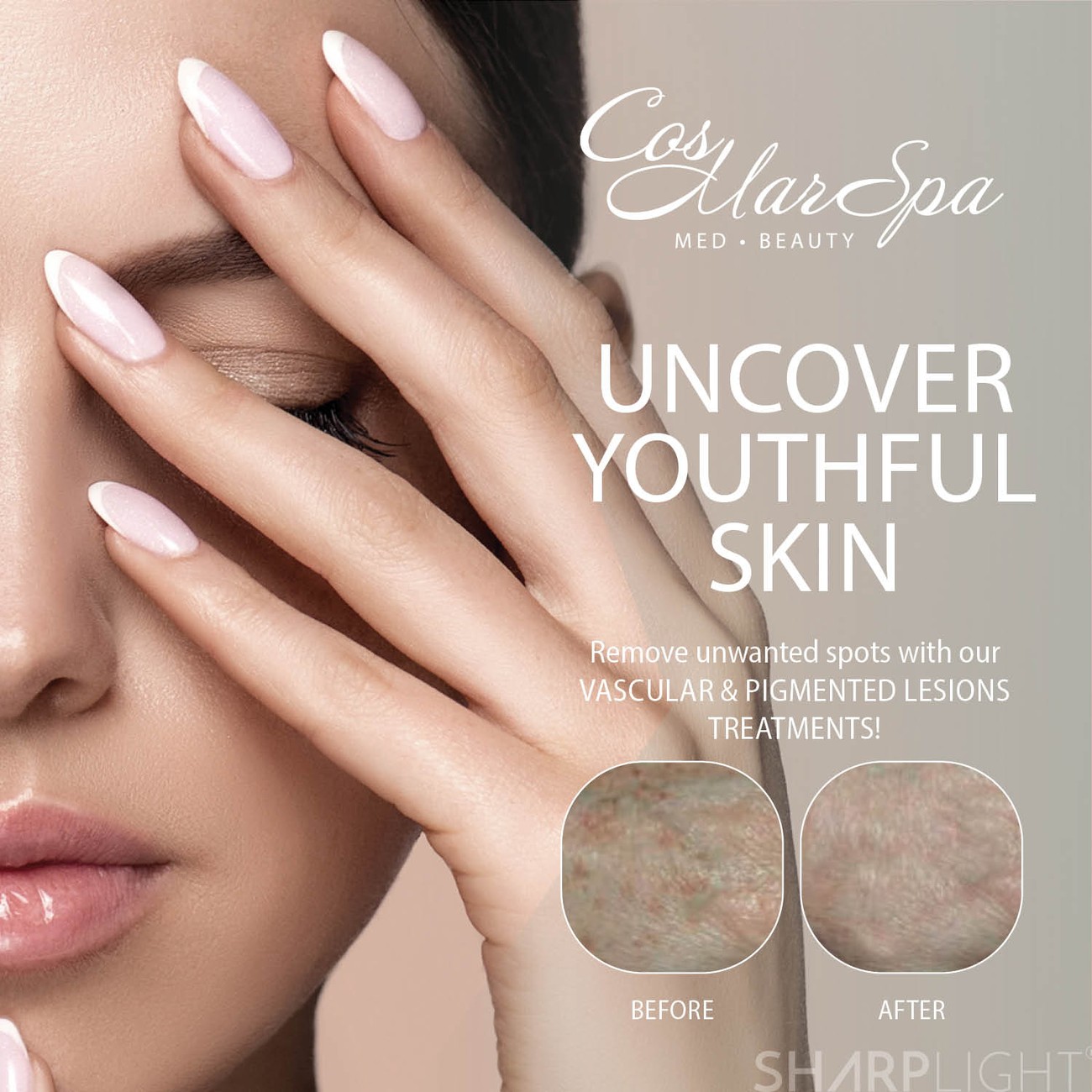 Pigmented lesion treatment